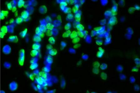 TUNEL LiFluor 488 Apoptosis Detection Kit